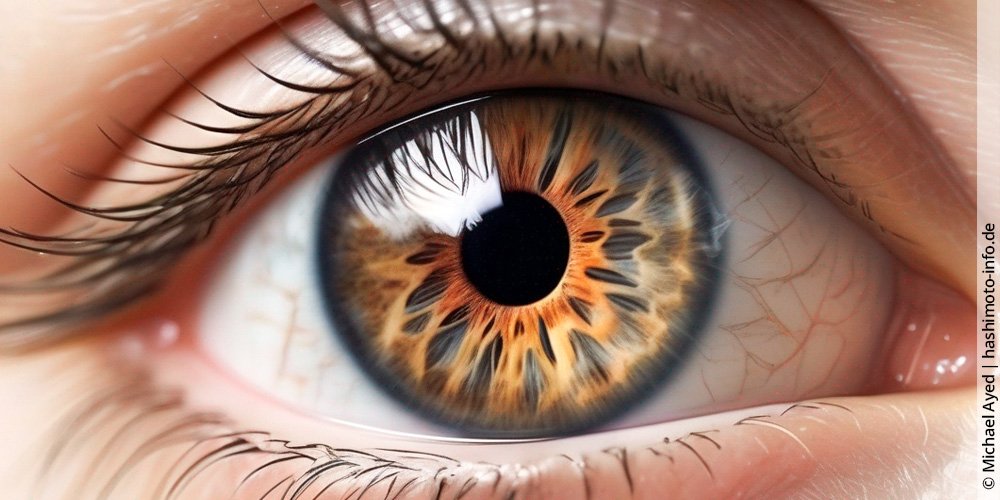 Augensymptome bei Hashimoto: Hat die Schilddrüse einen Einfluss auf die Augen?